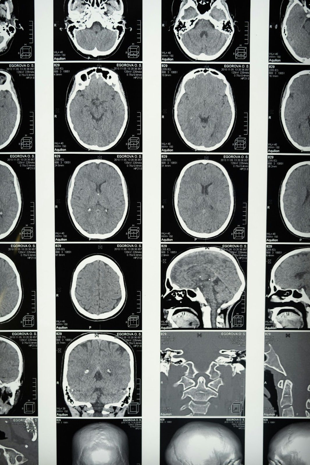 Brain scans