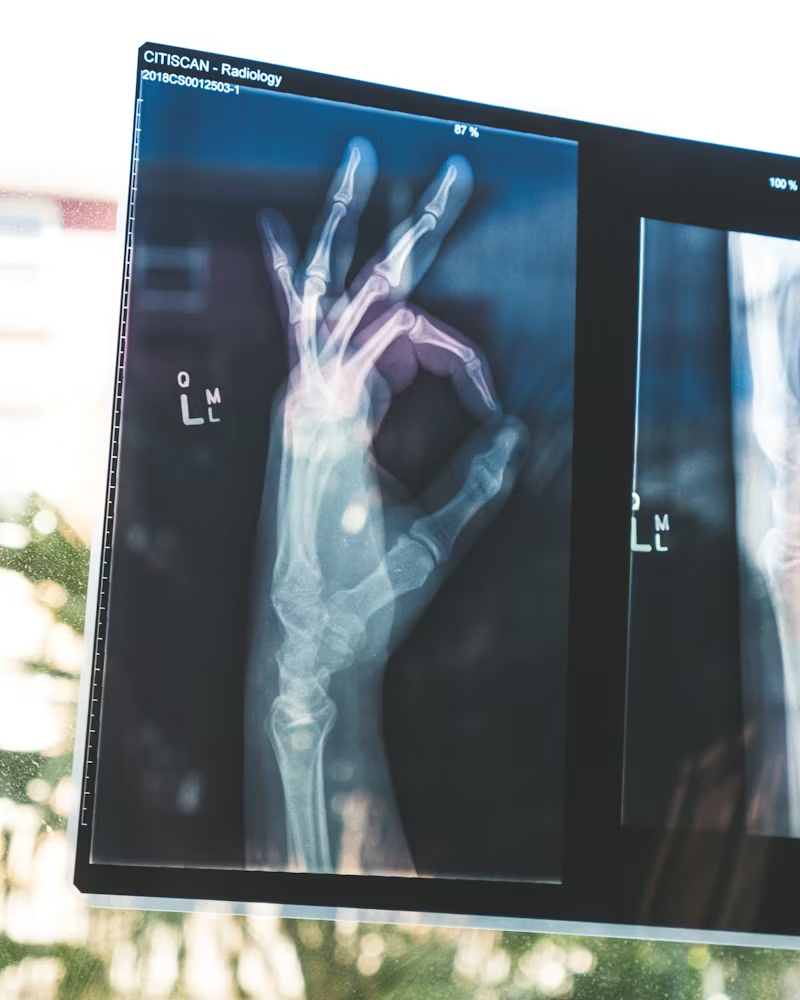 Xray