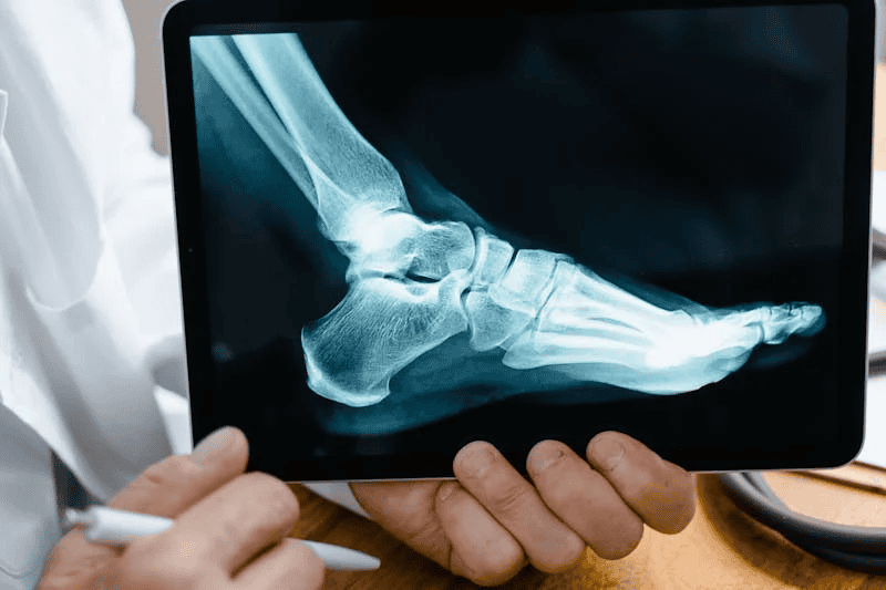 Foot and ankle surgery abroad