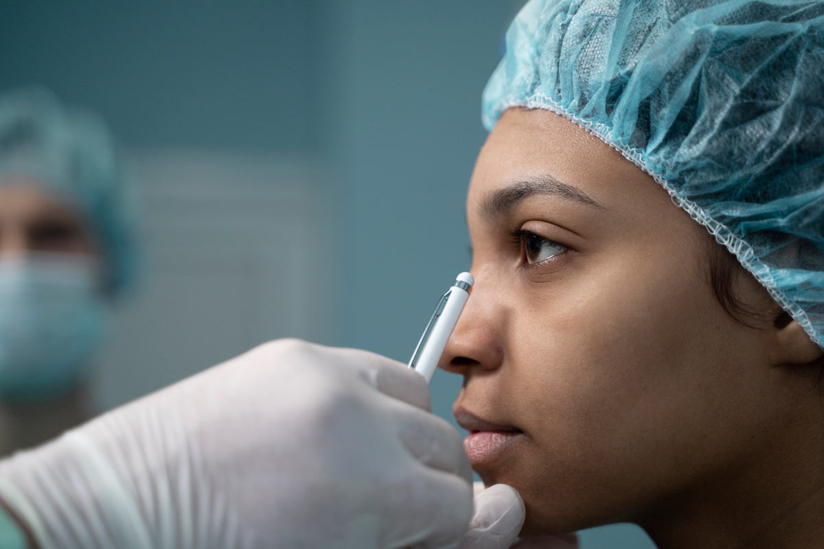 Rhinoplasty