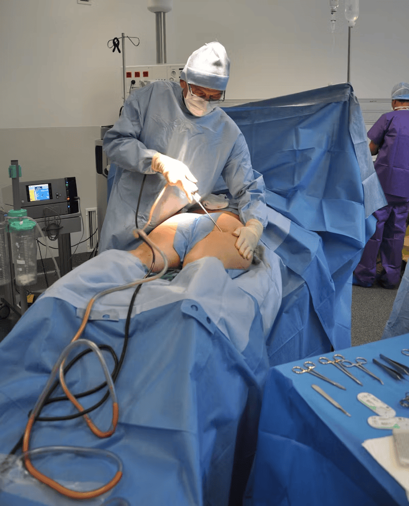 Weight loss surgery