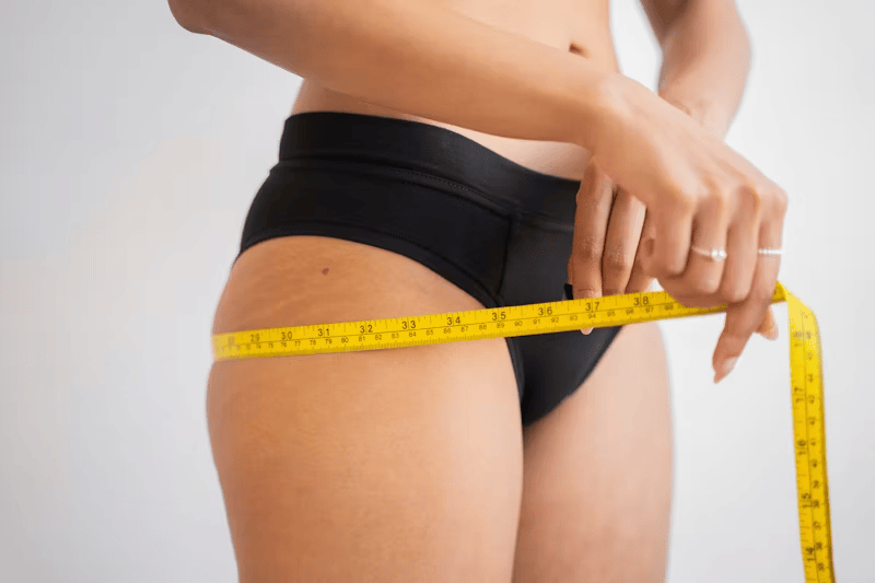 Weight loss surgery