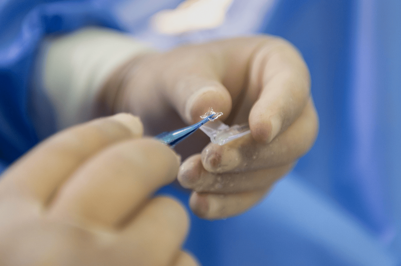 cancer treatment abroad